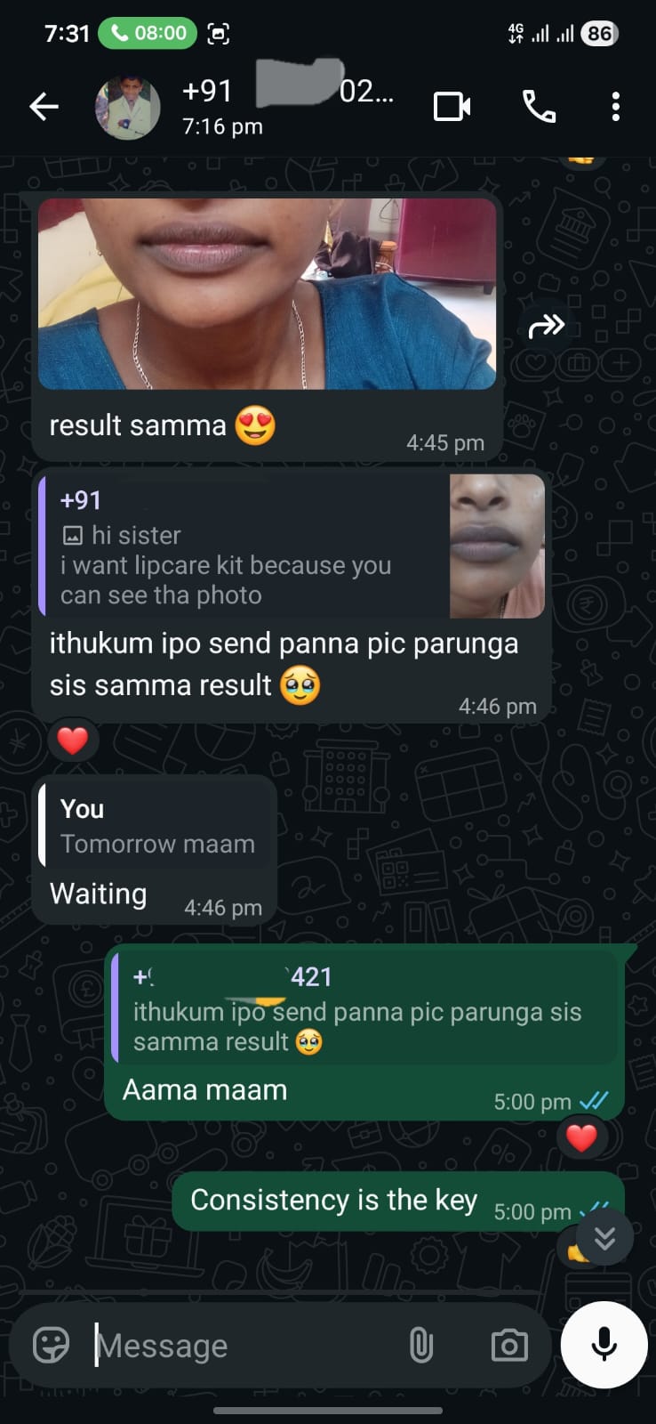 Customer Photo Proof: 'Result Samma 😍'